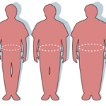 202px-Obesity-waist_circumference